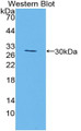 Western Blot; Sample: Recombinant protein.