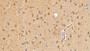 DAB staining on IHC-P; Sample: Human Cerebrum Tissue;  Primary Ab: 20μg/ml Rabbit Anti-Human MAP1LC3a Antibody Second Ab: 2µg/mL HRP-Linked Caprine Anti-Rabbit IgG Polyclonal Antibody 