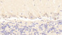 DABstainingonIHC-P.Samples:HumanTissue)