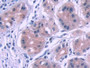 Figure. DAB staining on IHC-P; Samples: Human Stomach Tissue.