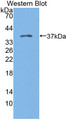 Western Blot; Sample: Recombinant protein.