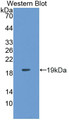 Western Blot; Sample: Recombinant protein.