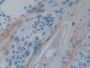 DAB staining on fromalin fixed paraffin-embedded pancreas tissue)