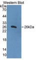 Western Blot; Sample: Recombinant protein.