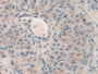DAB staining on IHC-P; Samples: Mouse Ovary Tissue; Primary Ab: 10µg/ml Rabbit Anti-Mouse HPS4 Antibody Second Ab: 2µg/mL HRP-Linked Caprine Anti-Rabbit IgG Polyclonal Antibody