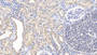 DAB staining on IHC-P; Samples: Human Kidney Tissue; Primary Ab: 20µg/ml Rabbit Anti-Human GFRa1 Antibody Second Ab: 2µg/mL HRP-Linked Caprine Anti-Rabbit IgG Polyclonal Antibody