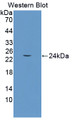 Western Blot; Sample: Recombinant protein.