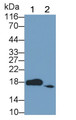 Western Blot; Sample: Lane1: Mouse Pancreas lysate; Lane2: K562 cell lysate; Primary Ab: 0.2µg/ml Rabbit Anti-Rat EIF4EBP1 Antibody; Second Ab: 0.2µg/mL HRP-Linked Caprine Anti-Rabbit IgG Polyclonal Antibody;