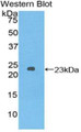 Western Blot; Sample: Recombinant protein.