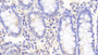 DAB staining on IHC-P; Samples: Human Colon Tissue;  Primary Ab: 20μg/ml Rabbit Anti-Human DTX1 Antibody Second Ab: 2µg/mL HRP-Linked Caprine Anti-Rabbit IgG Polyclonal Antibody 