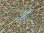 DAB staining on IHC-P; Samples: Human Liver Tissue