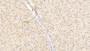 DAB staining on IHC-P; Samples: Human Liver Tissue;  Primary Ab: 20μg/ml Rabbit Anti-Human CIDEA Antibody Second Ab: 2µg/mL HRP-Linked Caprine Anti-Rabbit IgG Polyclonal Antibody 