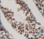 Checkpoint Kinase 1 (Chek1) Polyclonal Antibody, Cat#CAU21484