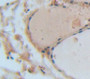 Angiogenic Factor With G Patch And Fha Domains 1 (Aggf1) Polyclonal Antibody, Cat#CAU21505