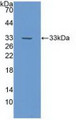 Western Blot; Sample: Recombinant NOTCH4, Human.