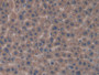 DAB staining on IHC-P; Samples: Rat Liver Tissue; Primary Ab: 20µg/ml Rabbit Anti-Rat FGFRL1 Antibody Second Ab: 2µg/mL HRP-Linked Caprine Anti-Rabbit IgG Polyclonal Antibody