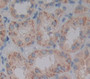 Programmed Cell Death Protein 5 (Pdcd5) Polyclonal Antibody, Cat#CAU21520