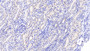 DAB staining on IHC-P; Samples: Human Kidney Tissue;  Primary Ab: 20μg/ml Rabbit Anti-Human WWP2 Antibody Second Ab: 2µg/mL HRP-Linked Caprine Anti-Rabbit IgG Polyclonal Antibody 