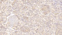 DAB staining on IHC-P; Samples: Human Spleen Tissue;  Primary Ab: 20μg/ml Rabbit Anti-Human UBR4 Antibody Second Ab: 2µg/mL HRP-Linked Caprine Anti-Rabbit IgG Polyclonal Antibody 