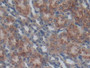 DAB staining on IHC-P; Samples: Mouse Kidney Tissue; Primary Ab: 20µg/ml Rabbit Anti-Mouse SPRY1 Antibody Second Ab: 2µg/mL HRP-Linked Caprine Anti-Rabbit IgG Polyclonal Antibody