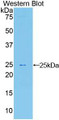 Western Blot; Sample: Recombinant protein.