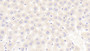 DAB staining on IHC-P; Samples: Rat Liver Tissue; Primary Ab: 10μg/ml Rabbit Anti-Rat SPRY3 Antibody Second Ab: 2µg/mL HRP-Linked Caprine Anti-Rabbit IgG Polyclonal Antibody