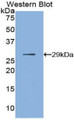 Western Blot; Sample: Recombinant protein.