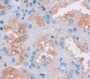 Used in DAB staining on fromalin fixed paraffin- embedded Kidney tissue