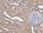 DAB staining on IHC-P; Samples: Human Kidney Tissue