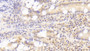 DAB staining on IHC-P; Samples: Human Small intestine Tissue;  Primary Ab: 20μg/ml Rabbit Anti-Human SLAMF7 Antibody Second Ab: 2µg/mL HRP-Linked Caprine Anti-Rabbit IgG Polyclonal Antibody 