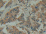 DAB staining on fromalin fixed paraffin-embedded rectum tissue)