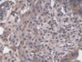 DAB staining on IHC-P; Samples: Mouse Uterus Tissue;  Primary Ab: 20µg/ml Rabbit Anti-Mouse PRKDC An