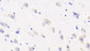 DAB staining on IHC-P; Samples: Human Cerebrum Tissue; Primary Ab: 20μg/ml Rabbit Anti-Human RAB5A Antibody Second Ab: 2µg/mL HRP-Linked Caprine Anti-Rabbit IgG Polyclonal Antibody