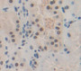 Used in DAB staining on fromalin fixed paraffin- embedded Kidney tissue