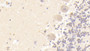 DAB staining on IHC-P; Samples: Human Cerebellum Tissue; Primary Ab: 20μg/ml Rabbit Anti-Human FYN Antibody Second Ab: 2µg/mL HRP-Linked Caprine Anti-Rabbit IgG Polyclonal Antibody