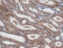 DAB staining on IHC-P; Samples: Human Kidney Tissue; Primary Ab: 20µg/ml Rabbit Anti-Human NME5 Antibody Second Ab: 2µg/mL HRP-Linked Caprine Anti-Rabbit IgG Polyclonal Antibody