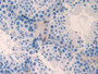 DAB staining on IHC-P; Samples: Mouse Testis Tissue;  Primary Ab: 20µg/ml Rabbit Anti-Mouse NME3 Ant
