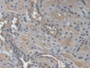 DAB staining on IHC-P; Samples: Human Kidney Tissue;  Primary Ab: 20µg/ml Rabbit Anti-Human NME3 Ant