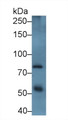 Western Blot; Sample: Human Placenta lysate; Primary Ab: 2µg/ml Rabbit Anti-Human ADAM12 Antibody; Second Ab: 0.2µg/mL HRP-Linked Caprine Anti-Rabbit IgG Polyclonal Antibody;