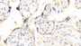 DAB staining on IHC-P; Samples: Human Placenta Tissue; Primary Ab: 20μg/ml Rabbit Anti-Human ADAM12 Antibody Second Ab: 2µg/mL HRP-Linked Caprine Anti-Rabbit IgG Polyclonal Antibody