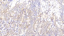 DABstainingonIHC-P.Samples:HumanTissue)