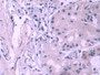 DAB staining on IHC-P; Samples: Human Stomach Tissue; Primary Ab: 10µg/ml Rabbit Anti-Human PES1 Antibody Second Ab: 2µg/mL HRP-Linked Caprine Anti-Rabbit IgG Polyclonal Antibody