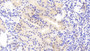 DABstainingonIHC-P.Samples:HumanTissue)