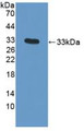 Western Blot; Sample: Recombinant SNAI1, Human.