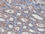 DAB staining on IHC-P; Samples: Human Kidney Tissue;  Primary Ab: 20µg/ml Rabbit Anti-Human SNAI1 An