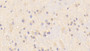 DAB staining on IHC-P; Samples: Mouse Cerebrum Tissue; Primary Ab: 20μg/ml Rabbit Anti-Mouse CARNS1 Antibody Second Ab: 2µg/mL HRP-Linked Caprine Anti-Rabbit IgG Polyclonal Antibody