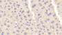 DAB staining on IHC-P; Samples: Mouse Liver Tissue;  Primary Ab: 20μg/ml Rabbit Anti-Mouse CARNS1 Antibody Second Ab: 2µg/mL HRP-Linked Caprine Anti-Rabbit IgG Polyclonal Antibody 