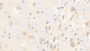 DAB staining on fromalin fixed paraffin-embedded Liver tissue)