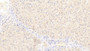 DAB staining on IHC-P; Samples: Human Liver Tissue; Primary Ab: 20μg/ml Rabbit Anti-Human NUMB Antibody Second Ab: 2µg/mL HRP-Linked Caprine Anti-Rabbit IgG Polyclonal Antibody