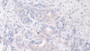 DAB staining on fromalin fixed paraffin- embedded skeletal muscle tissue)